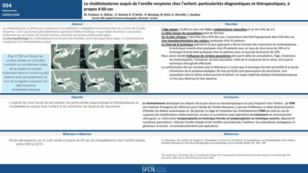 454_KHALED_Harrathi_P004—Le-cholestéatome-acquis-de-particularités-diagnostiques-et-thérapeutiques,-à-propos-de-60-cas