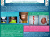 470_TIMI-KAOURA_NASSER_P020—Kystes-et-fistules-congénitaux-cervico-faciaux–aspects-épidémiologiques,-cliniques-et-thérapeutiques-au-Niger
