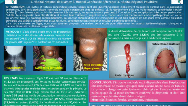 470_TIMI-KAOURA_NASSER_P020—Kystes-et-fistules-congénitaux-cervico-faciaux–aspects-épidémiologiques,-cliniques-et-thérapeutiques-au-Niger