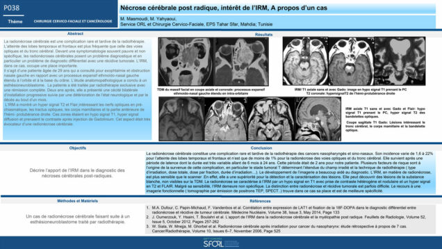 487_Masmoudi_mohamed_P038—Nécrose-cérébrale-post-radique,-intérêt-de-lIRM