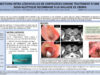 45_UCELAY-GALLASTEGUI_Maria_Injections-intra-lesionnelles-de-corticoides-comme-traitement-d-une-stenos