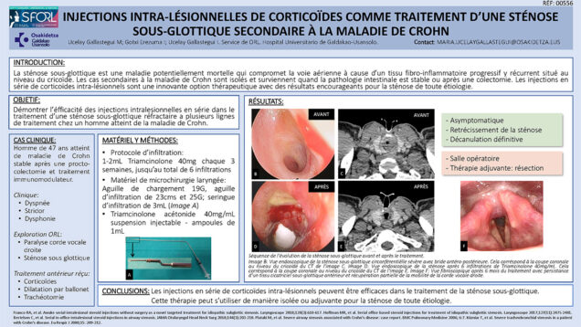 45_UCELAY-GALLASTEGUI_Maria_Injections-intra-lesionnelles-de-corticoides-comme-traitement-d-une-stenos