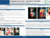 462_Fontes-Lima_Antonio_P012-Paraganglioma-of-the-larynx-–-case-report-of-a-rare-entity