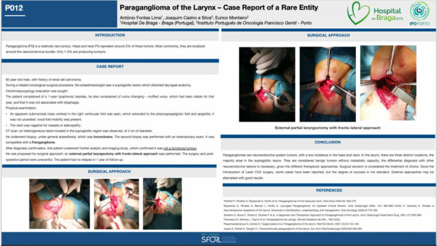 462_Fontes-Lima_Antonio_P012-Paraganglioma-of-the-larynx-–-case-report-of-a-rare-entity