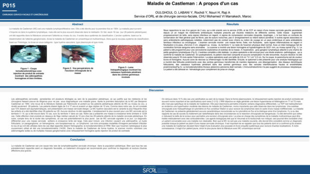 465_oulghoul_omar_P015-Maladie-de-Castleman-de-localisation-cervicale-chez-lenfant-a-propos-dun-cas