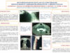 471_zaroual_atmane_P021-Abces-retropharynge-revelant-un-corps-etranger-migrant-complique-de-mediastinite-a-propos-dun-cas