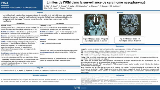 473_Meherzi_Abir_P023-Limites-de-RM-dans-la-surveillance-de-carcinome-nasopharynge