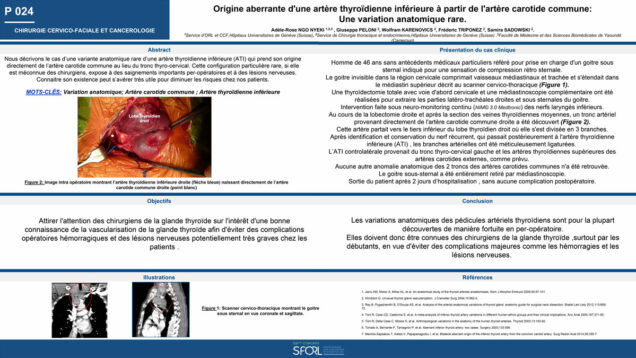 474_Ngo-Nyeki-Mouaha-bell_Adele-rose_P024-Origine-aberrantertere-thyroidienne-inferieure-a-partir-dearotide-commune-Une-variation-anatomique-rare