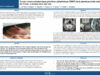 476_Ait-taleb-oum&rsquo;hand_Hajar_P026—Tumeur-neuro-ectodermique-primitives-périphérique