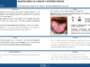 478_Aguiar_Cristina_P028-Macroglossia-as-a-sign-of-a-systemic-disease