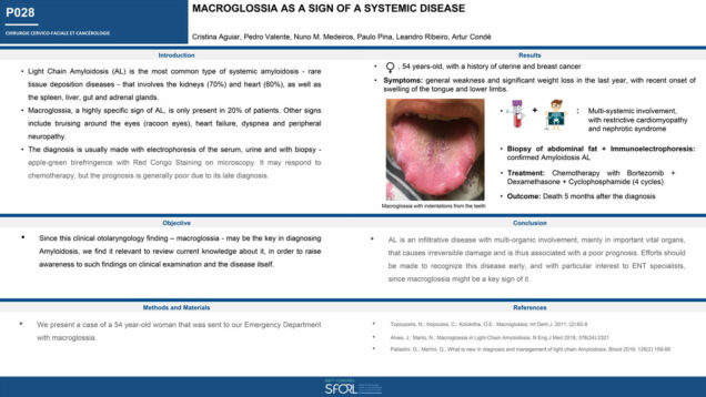 478_Aguiar_Cristina_P028-Macroglossia-as-a-sign-of-a-systemic-disease