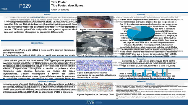 479_elkhalifa_youssef_P029-Hemangioendotheliome-epithelioide-EHE-de-la-thyroide-a-propos-dun-cas