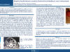 486_ZITOUNI_SOUAD_P037-Abces-thyroidien-idiopathique-provoque-par-Escherichia-coli-entrainant-une-paralysie-des-cordes-vocales