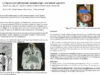 491_Diouf_Mame-Sanou_P042-Le-liposarcome-pleomorphe-nasopharynge-une-tumeur-agressive
