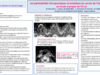 495_houas_jihene_P046-Les-particularites-therapeutiques-et-evolutives-du-cancer-de-lhypopharynx-un-etude-a-propos-de-43-cas