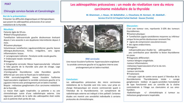 496_houas_jihene_P047-Les-adenopathies-precessives-un-mode-de-revelation-rare-du-micro-carcinome-medullaire-de-la-thyroide