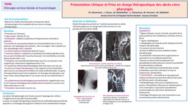 497_houas_jihene_P048-Presentation-clinique-et-Prise-en-charge-therapeutique-des-abces-retro-pharynges