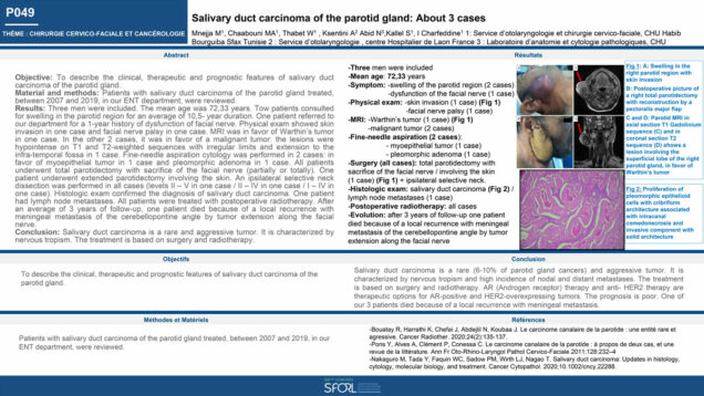 498_Chaabouni_Mohamed-Amin_P049-Salivary-duct-carcinoma-of-the-parotid-gland-About-3-cases