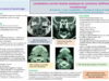 507_houas_jihene_P058-Localisations-cervico-faciales-atypiques-du-carcinome-indifferencie-de-type-nasopharynge