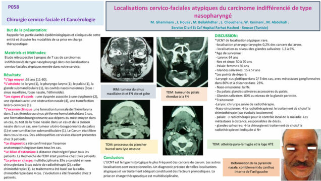 507_houas_jihene_P058-Localisations-cervico-faciales-atypiques-du-carcinome-indifferencie-de-type-nasopharynge