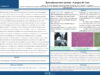 509_KHARRAT_INES_P060-Synovialosarcome-cervical-a-propos-de-3-cas