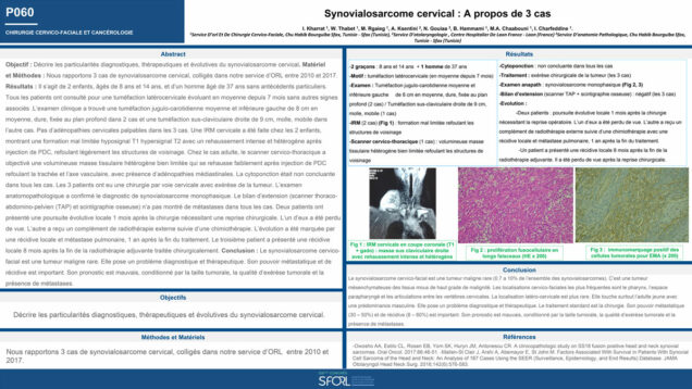 509_KHARRAT_INES_P060-Synovialosarcome-cervical-a-propos-de-3-cas