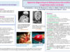 515_houas_jihene_P066-Approche-diagnostique-et-therapeutique-des-malformations-congenitales-latero-cervicales