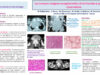 516_houas_jihene_P067-Les-tumeurs-malignes-exceptionnelles-de-la-thyroide-a-propos-de-11-observations