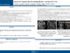517_Mkhatri_Amine_P068-Apport-de-limagerie-dans-les-paragangliomes-a-propos-de-11-cas