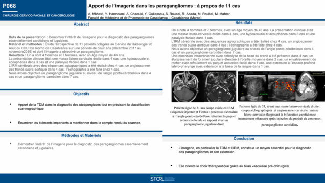 517_Mkhatri_Amine_P068-Apport-de-limagerie-dans-les-paragangliomes-a-propos-de-11-cas
