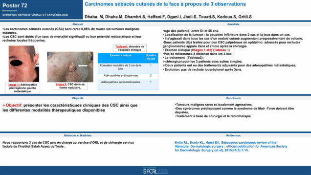 521_DHAHA_Mohamed_P072-Carcinomes-sebaces-cutanes-de-la-face-a-propos-de-3-observations