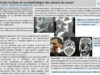 522_JBALI_Souheil_P073-Les-complications-tardives-de-la-radiotherapie-des-cancers-du-cavum