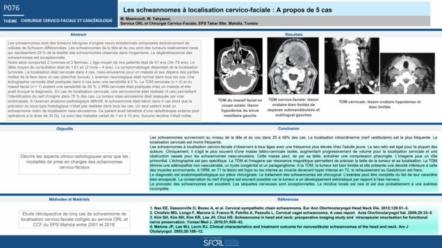 525_Masmoudi_mohamed_P076-Les-schwannomes-a-localisation-cervico-faciale-A-propos-de-5-cas
