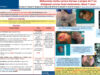 528_Bouatay_rachida_P079-Melanomes-malins-cervico-faciaux-a-propos-de-7-cas