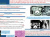 529_Bouatay_rachida_P080-Lymphome-non-hodgkinien-primitif-de-la-thyroide-a-propos-de-quatre-observations