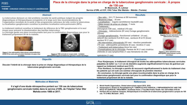 534_Masmoudi_mohamed_P085-Place-de-la-chirurgie-dans-la-prise-en-charge-de-la-tuberculose-ganglionnaire-cervicale-A-propos-de-130-cas