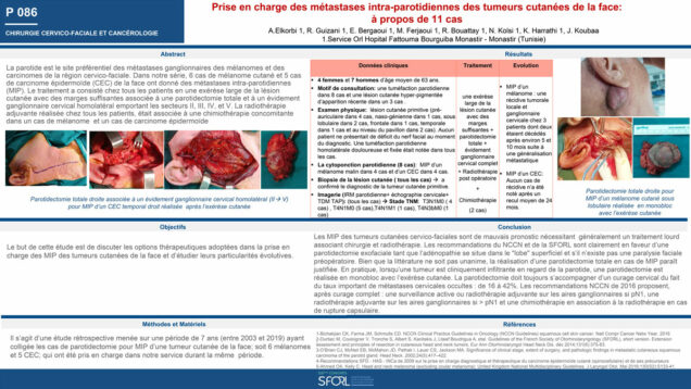 535_KHALED_Harrathi_P086-Prise-en-charge-des-metastases-intra-parotidiennes-MIP-des-tumeurs-cutanees-de-la-face-a-propos-de-11cas