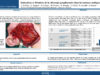 536_KHALED_Harrathi_P087-Indications-et-Resultats-de-la-chirurgie-ganglionnaire-dans-les-tumeurs-malignes-de-la-parotide