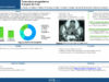 537_KHALED_Harrathi_P088-Tuberculose-amygdalienne-a-propos-de-5-cas