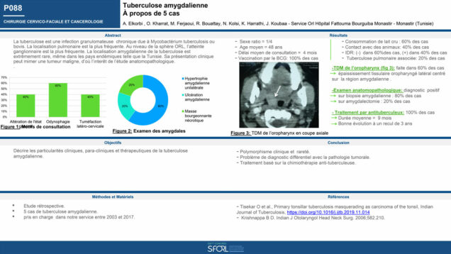537_KHALED_Harrathi_P088-Tuberculose-amygdalienne-a-propos-de-5-cas