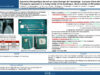 541_KHALED_Harrathi_P092-Approche-therapeutique-devant-un-corps-etranger-de-loesophage-a-propos-dune-serie-de-380-cas