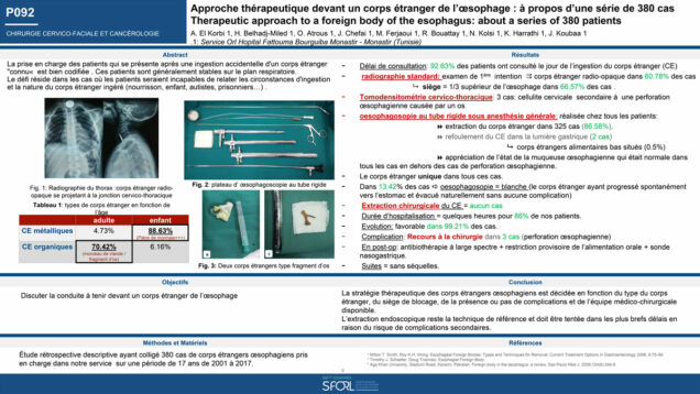 541_KHALED_Harrathi_P092-Approche-therapeutique-devant-un-corps-etranger-de-loesophage-a-propos-dune-serie-de-380-cas