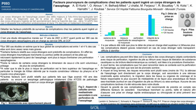 542_KHALED_Harrathi_P093-Facteurs-pourvoyeurs-de-complications-chez-les-patients-ayant-ingere-un-corps-etranger-de-loesophage