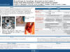 544_KHALED_Harrathi_P095-Corps-etranger-de-loesophage-dans-quels-cas-faut-il-operer