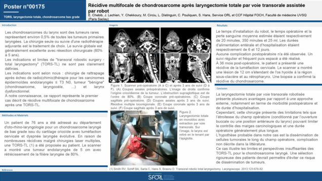 545_CHEBIB_Emilien_P096-Recidive-multifocale-de-chondrosarcome-apres-laryngectomie-totale-par-voie-transorale-assistee-par-robot