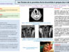 551_El-omri_Malika_P102-Les-fistules-de-la-premiere-fente-branchiale-A-propos-des-4-observations