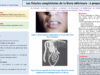 552_El-omri_Malika_P103-Les-fistules-congenitales-de-la-levre-inferieure-a-propos-dun-cas