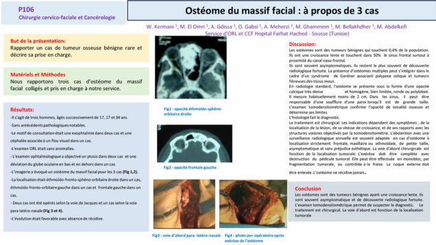 555_El-omri_Malika_P106-Osteome-du-massif-facial-a-propos-de-3-cas