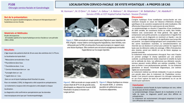 557_El-omri_Malika_P108-Localisation-cervico-facial-de-kyste-hydatique-a-propos-de-18-cas