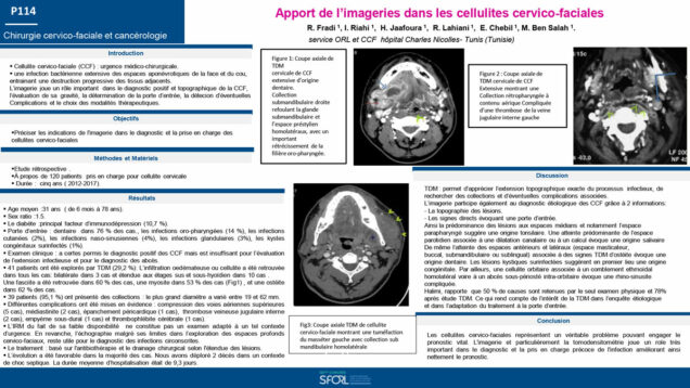 563_rim_fradi_P114-Apport-de-limagerie-dans-les-cellulites-cervico-faciales